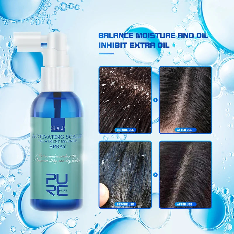 Scalp Activating Treatment Spray