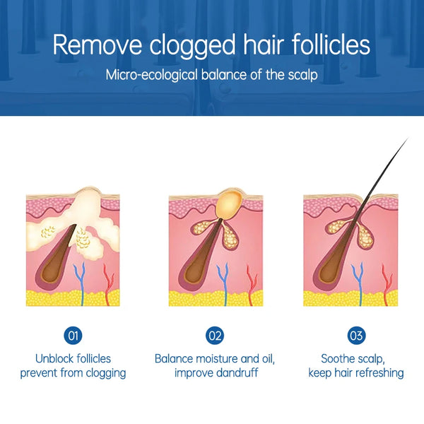Scalp Activating Treatment Spray