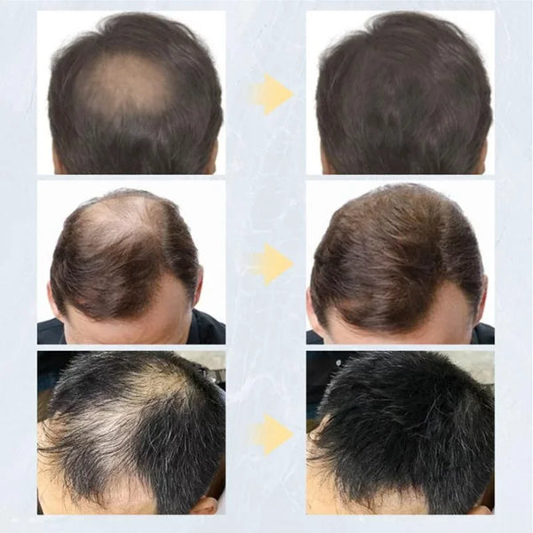 Natural Keratin Styling Hair Fibers