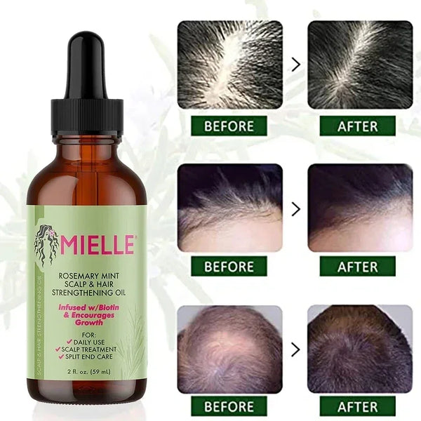BIOTIN Infused Rosemary & Mint Hair Strengthening Oil